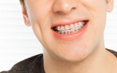 La Mejor Atención Dental para tus hijos en Colmenar de Oreja con Zaldent